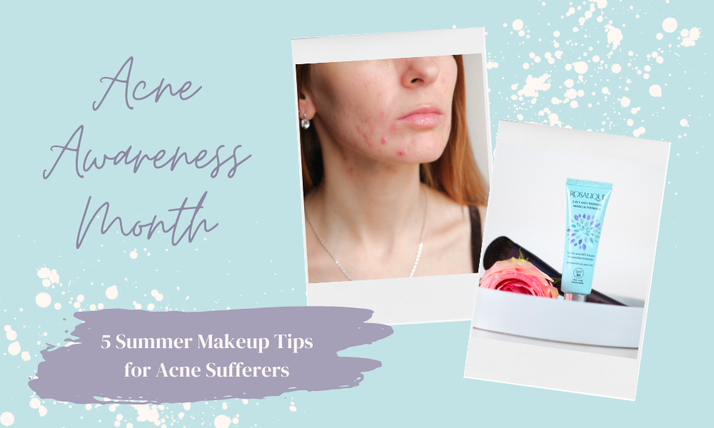 Rosalique, 5 conseils de maquillage d'été pour les personnes souffrant d'acné