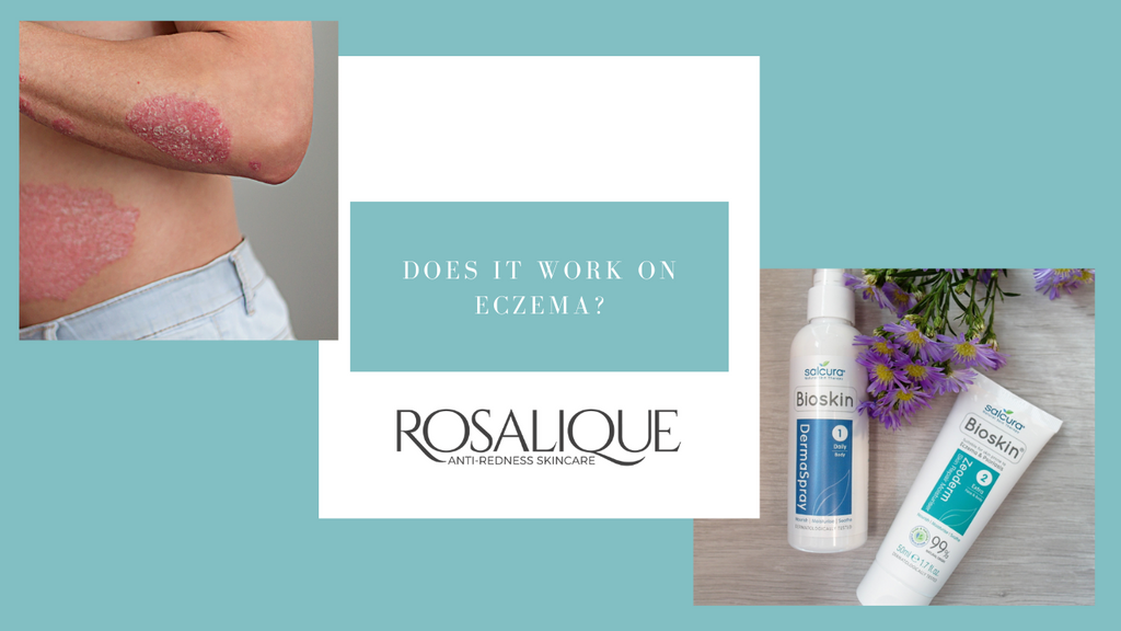 Est ce que la cosmétique technologique du soin Rosalique aide à réduire les sensibilités causés par l'eczéma ?