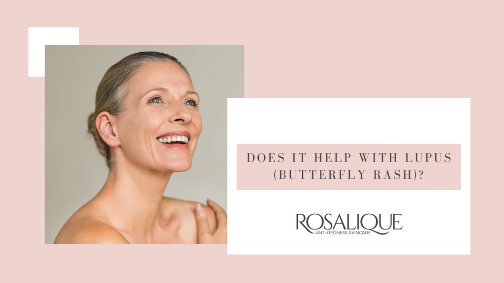  Un grand nombre de nos clients nous ont informés que Rosalique  aide à lutter contre l'érythème causé par le lupus. Cependant nous sommes un soin bio-technologique et cosmétique qui apaisons les rougeurs. 