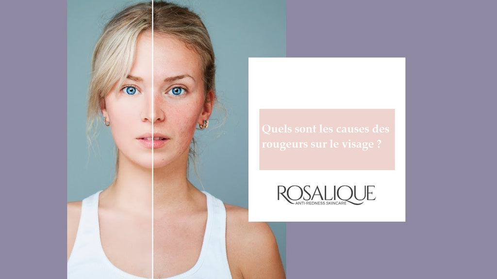 Rosalique, Quelles sont les causes des rougeurs sur le visage?